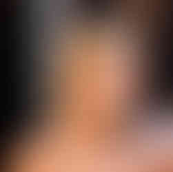 Hailey Bieber walking with Justin Bieber in a floral dress, showing natural yet enhanced look.