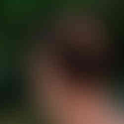 John Cena hair transplant scar healing process alongside red carpet look.