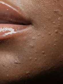 Top 5 Medspa Treatments for Achieving Radiant Glowing Skin