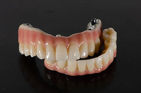 The all-on four dental prosthesis on implants.jpg