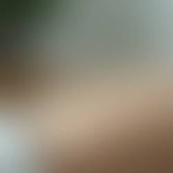 Acupuncture Benefits: Pain Relief for Athletes