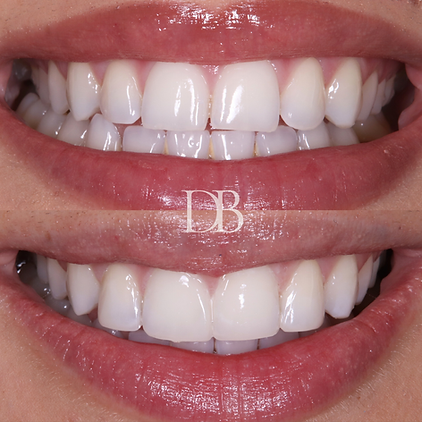 Before and Afters (26).png