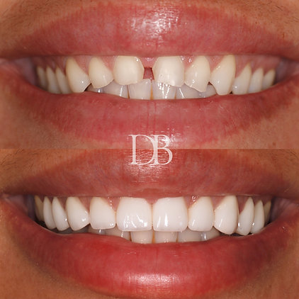 Before and Afters (21).png