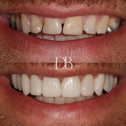 Before and Afters (25).png