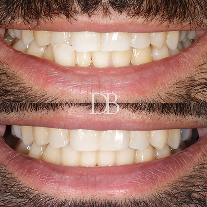 Before and Afters (9).png