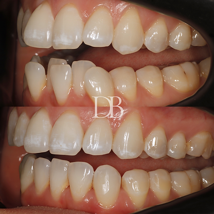 Before and Afters (8).png