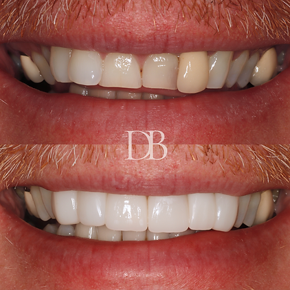 Before and Afters (16).png