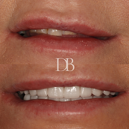 Before and Afters (12).png