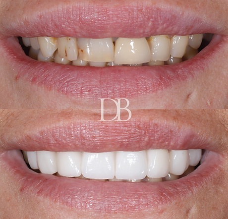 Before and Afters (6).png
