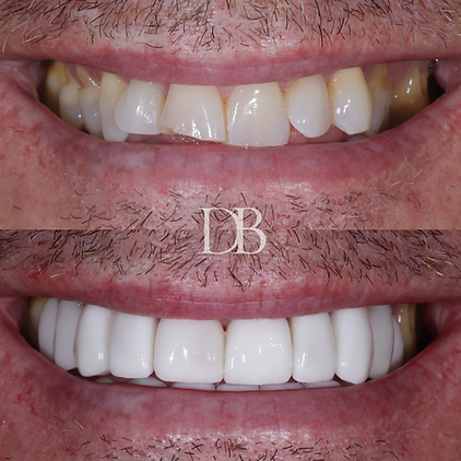 Before and Afters (24).png