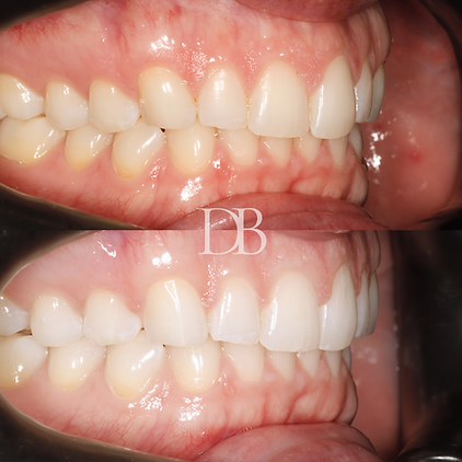 Before and Afters (10).png