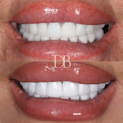 Carla Lawson (2).png