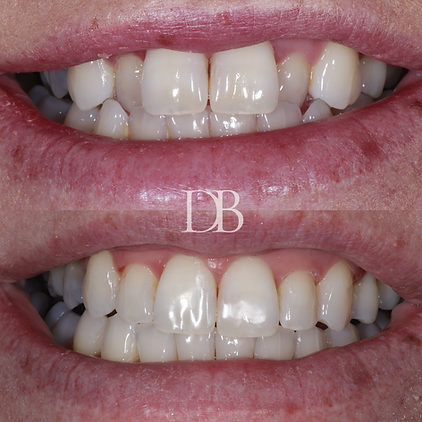 Before and Afters (7).png