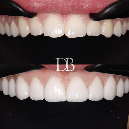 Before and Afters (17).png