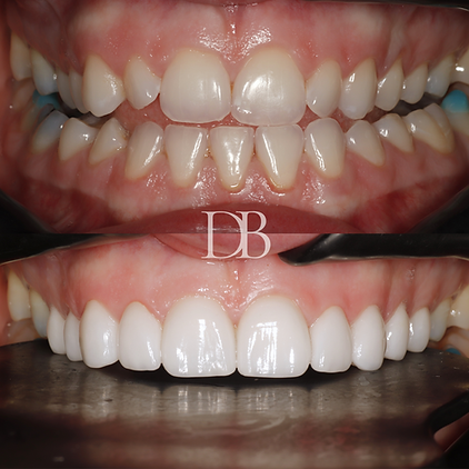 Before and Afters (20).png