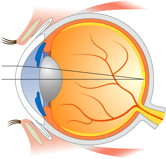 eye