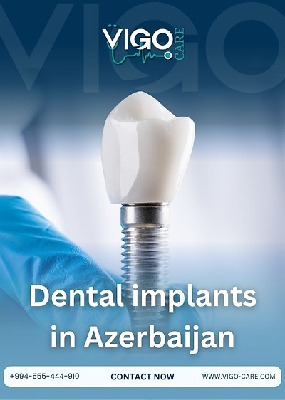Dental Implants in Azerbaijan - Dental Implant Guide in Azerbaijan