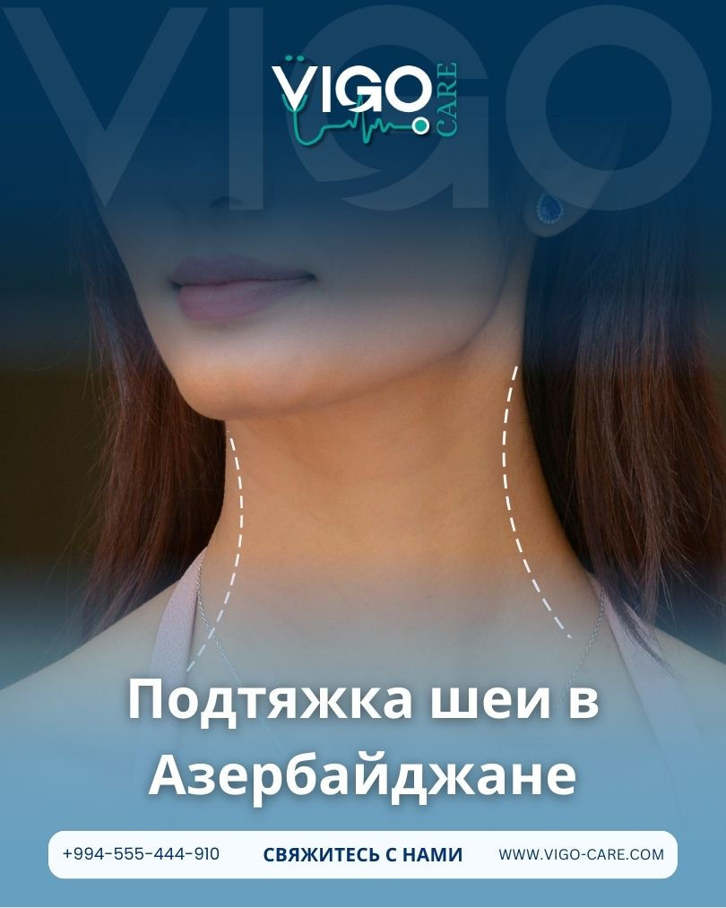 Подтяжка шеи в Азербайджане – улучшение контуров шеи и линии челюсти