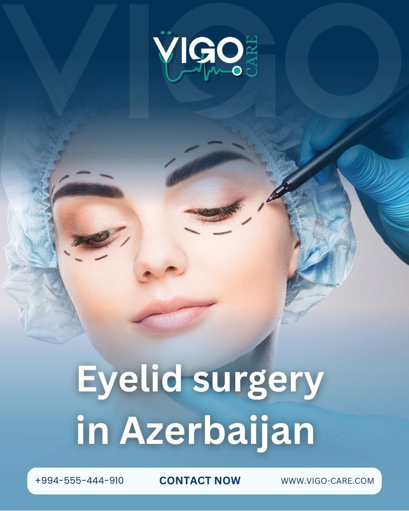 Eyelid Surgery in Azerbaijan