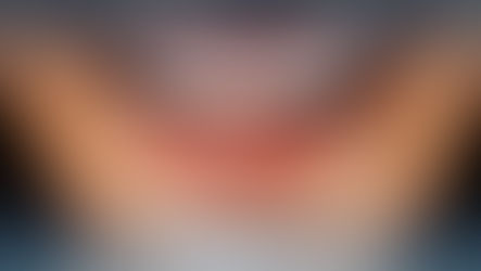 Давайте познакомимся с основными моментами эстетической стоматологии в Азербайджане, которые важны для пациента.  Стоимость эстетической стоматологии в Азербайджане - почему эстетическая стоматология в Азербайджане - преимущества эстетической стоматологии в Азербайджане - как проходит эстетическая стоматология в Азербайджане - вопросы об эстетической стоматологии в Азербайджане.