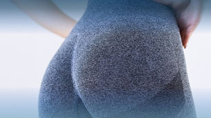 Увеличение ягодиц в Азербайджане: уверенность и красивые контуры