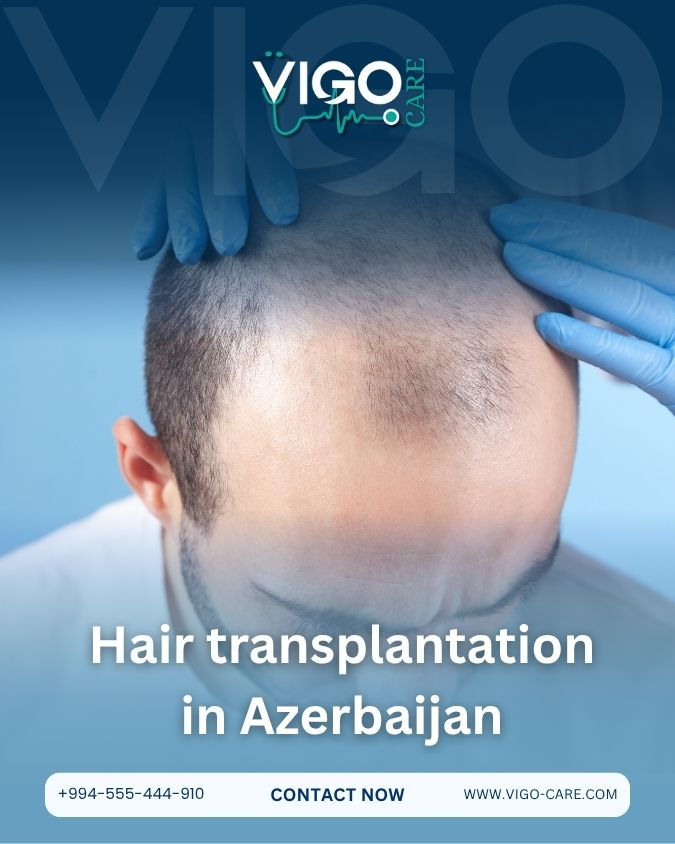 Hair transplantation in Azerbaijan: Your secret to confident, youthful, and natural appearance