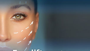 Facelift Surgery in Azerbaijan – Restore Youthful Contours and Confidence