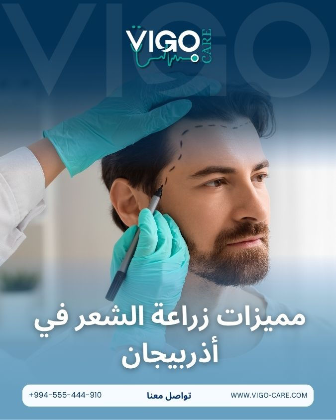 مميزات زراعة الشعر في أذربيجان