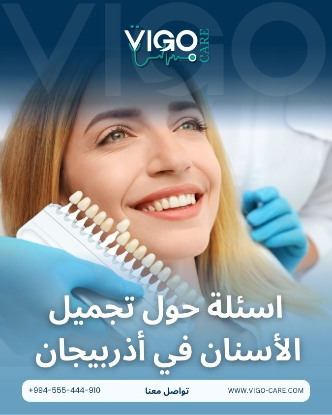 اسئلة شائعة حول تجميل الاسنان في اذربيجان