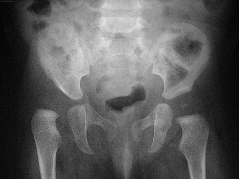 osteoimage40.gif