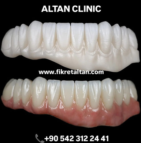 immediate-hizli-yuklemeli-implant