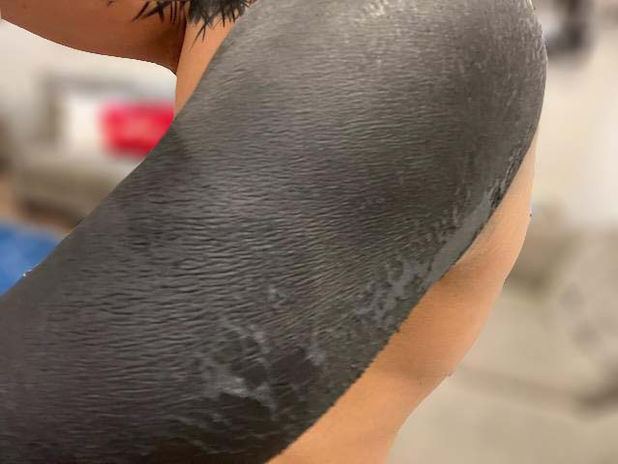 blackout tattoo healing 11.jpg