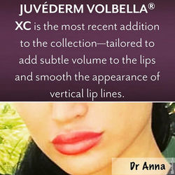 Beautiful volume for your lips that lasts 1 year!  Subtle and smooth for that elegant youthful look