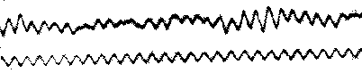 Brainwaves
