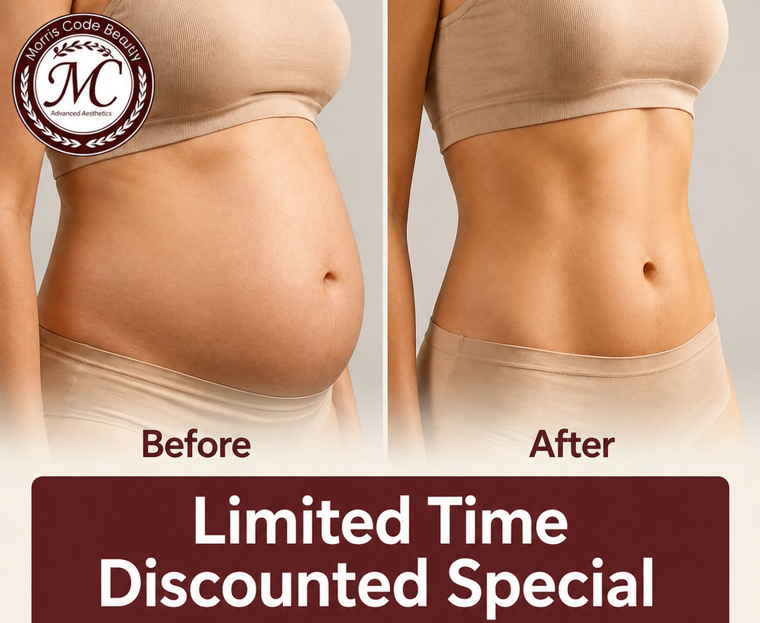 EMSHAPE Muscle Toning / Fat Reducing Treatment
