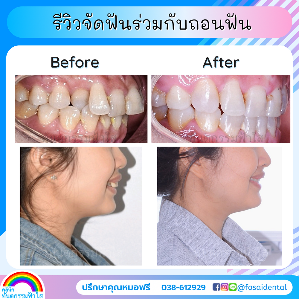 b3c9c3_4556a4d818d540faaf9e132880fe3fec~