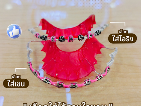 รีเทนเนอร์แบล็กเก็ต