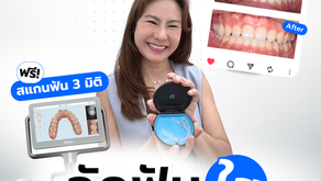 จัดฟันใส Invisalign