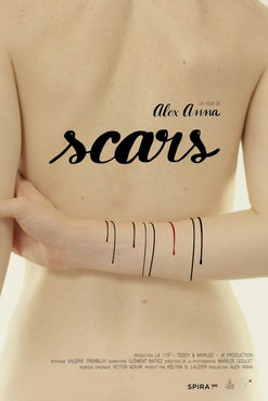 Scars (Canada) by Alex Anna.jpg
