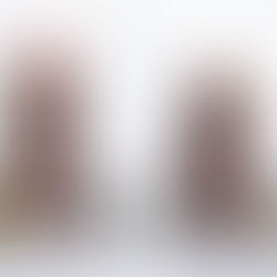 DARK CHOCOLATE COCONUT SQUARES