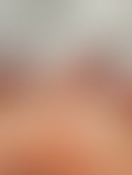 Δίδυμος κύηση και φυσιολογικός τοκετός