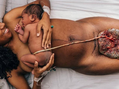 Μαθαίνοντας για το VBAC (Μέρος Ά)