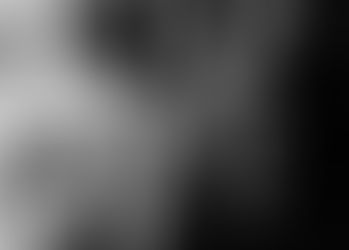 Επισκληρίδιος αναλγησία στον φυσιολογικό τοκετό