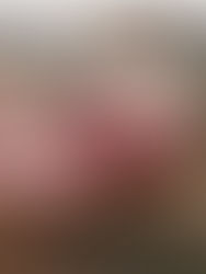 Εμβρυικό σμήγμα: Μανδύας προστασίας για το νεογνό