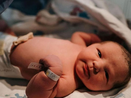 Αποθηλασμός