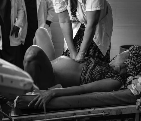 Χειρισμός Kristeller