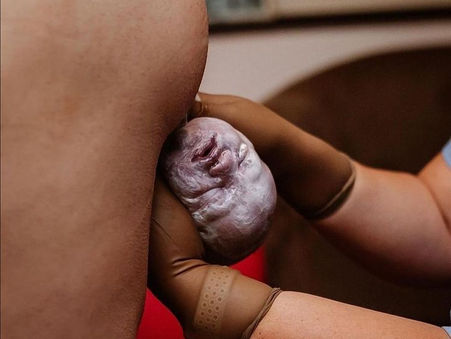 Η ημέρα της γέννησης (Μέρος Α' )