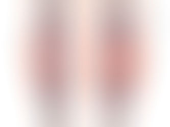 Varicose Vein Calf Muscle Pump