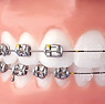 orthodontics-1.jpg