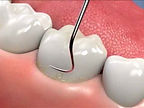 teeth cleaning-2_edited.jpg